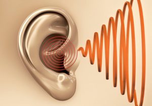 Aparelhos auditivos BH/Aparelhos auditivos - Perda auditiva neurosensorial