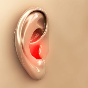Aparelhos auditivos BH/Aparelhos auditivos - Perda auditiva mista